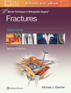 Master Techniques in Orthopaedic Surgery: Fractures, 4ED