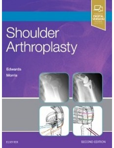 Shoulder Arthroplasty, 2ED
