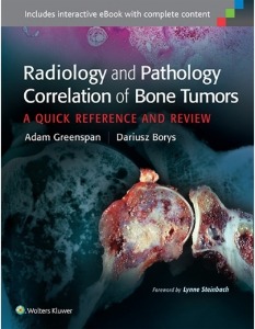 Radiology and Pathology Correlation of Bone Tumors: A Quick Reference and Review